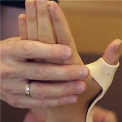 de Quervian Syndrome - Thumb Tendonitis